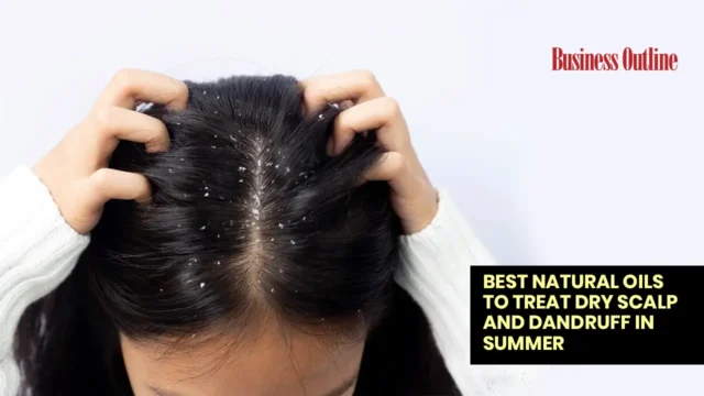 Best natural oils to treat dry scalp and dandruff in summer copy 1